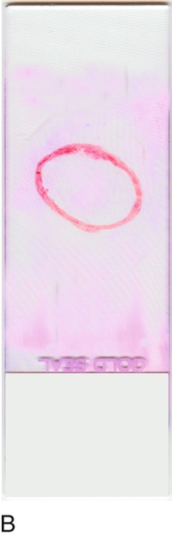 u24-01b-9780323322492