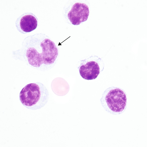 u24-03-9780323322492