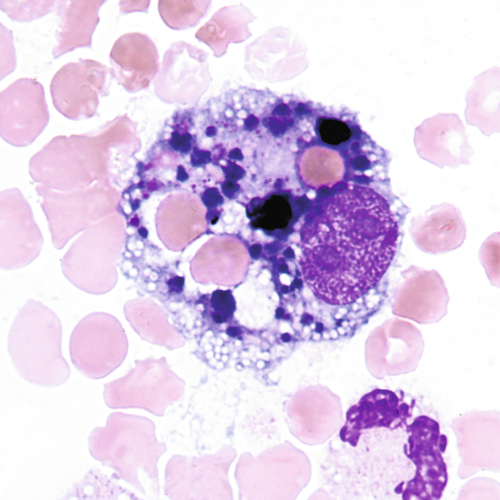 u24-10-9780323322492