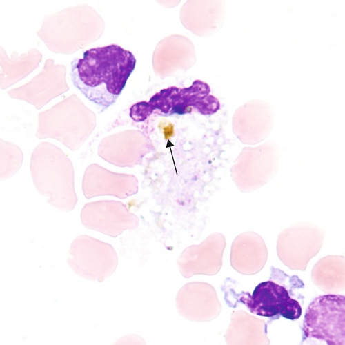 u24-11-9780323322492