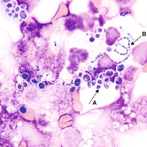 u24-13-9780323322492