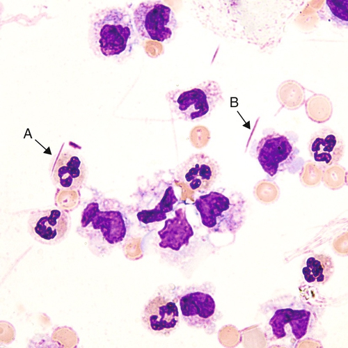 u24-30-9780323322492