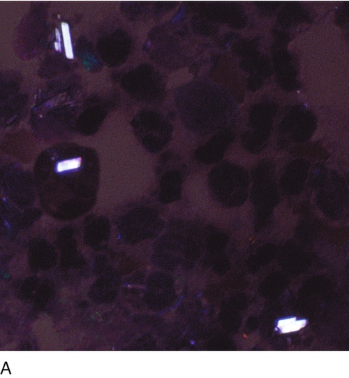 u24-34a-9780323322492