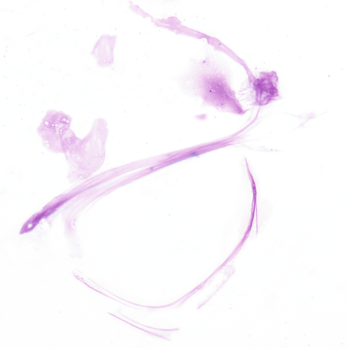 u24-38-9780323322492