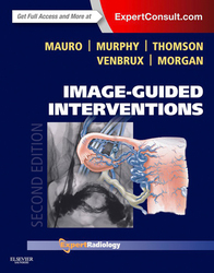 Image-Guided Interventions E-Book