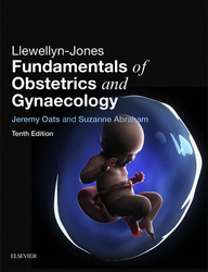 Llewellyn-Jones Fundamentals of Obstetrics and Gynaecology E-Book
