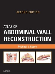 Atlas of Abdominal Wall Reconstruction E-Book