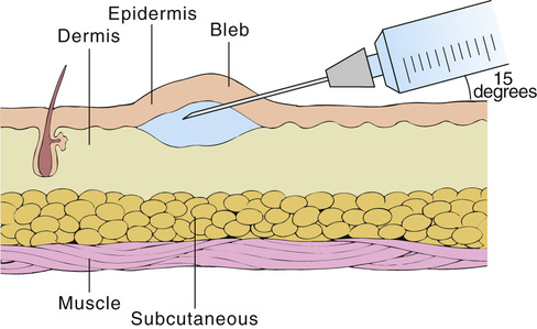 Basic Pharmacology for Nurses