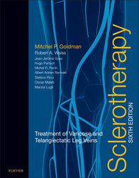 Sclerotherapy E-Book