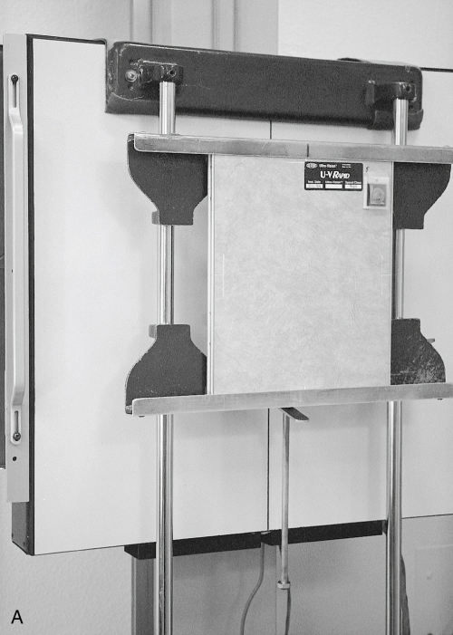 Radiography Essentials : For Limited Practice