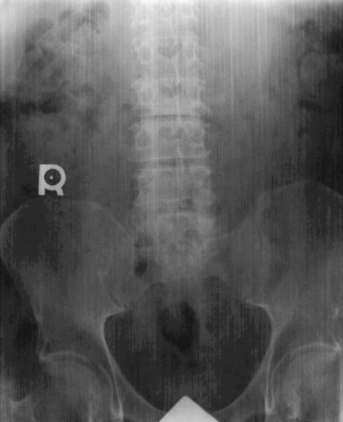 Radiography Essentials : For Limited Practice