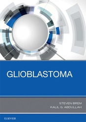 Glioblastoma E-Book