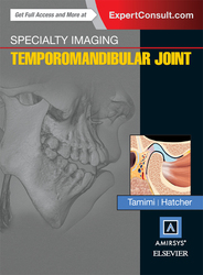 Specialty Imaging: Temporomandibular Joint E-Book