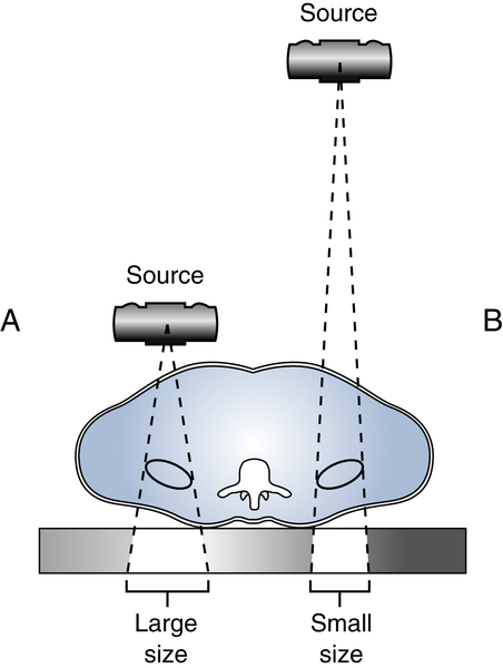 Radiographic Imaging and Exposure