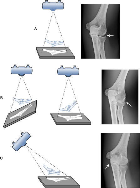 Radiographic Imaging and Exposure