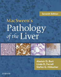 MacSween's Pathology of the Liver E-Book