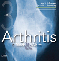 Arthritis in Black and White E-Book