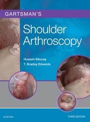 Gartsman's Shoulder Arthroscopy