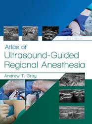 Atlas of Ultrasound-Guided Regional Anesthesia E-Book
