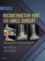 Reconstructive Foot and Ankle Surgery: Management of Complications E-Book