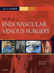 Atlas of Endovascular Venous Surgery E-Book