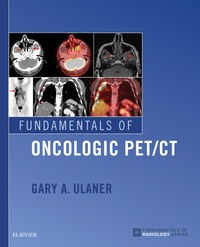 Fundamentals of Oncologic PET/CT E-Book