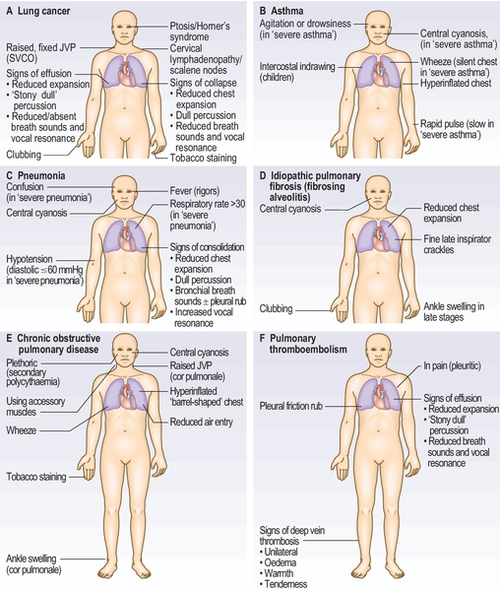 f03-04-9780702054815