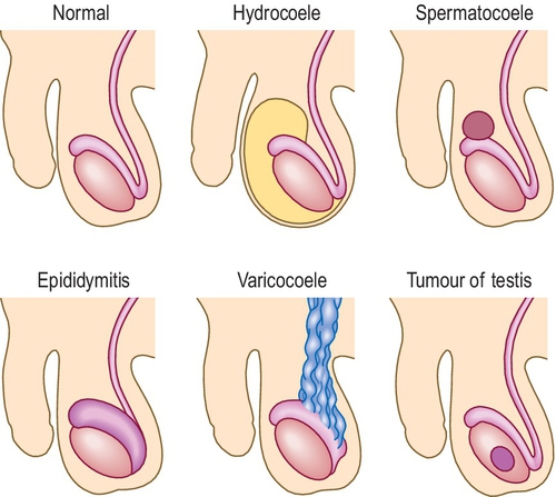 f03-09-9780702054815