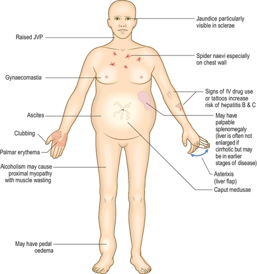 f03-10-9780702054815