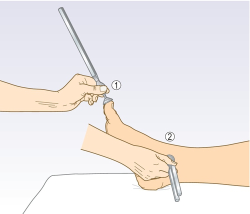 f03-14-9780702054815