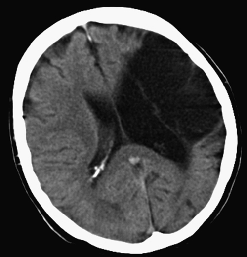 f03-16-9780702054815