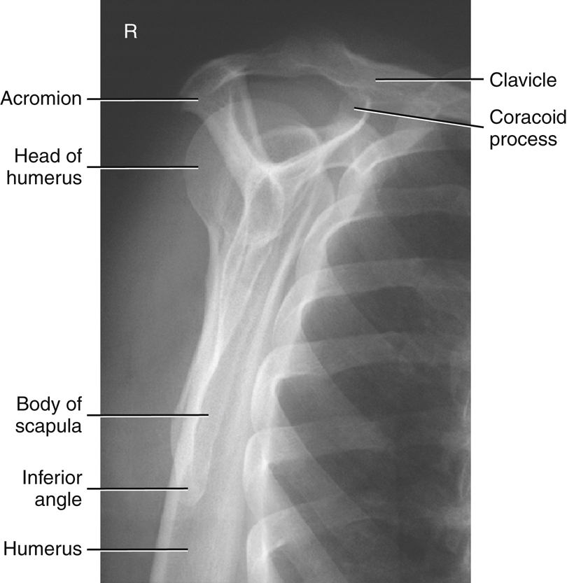 Bontrager's Textbook of Radiographic Positioning and Related Anatomy