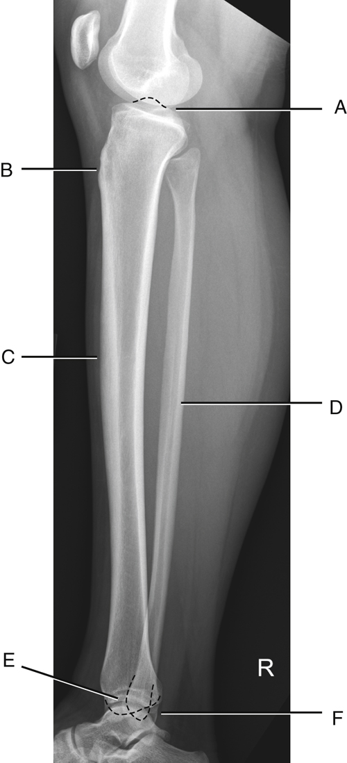 Bontrager's Textbook of Radiographic Positioning and Related Anatomy