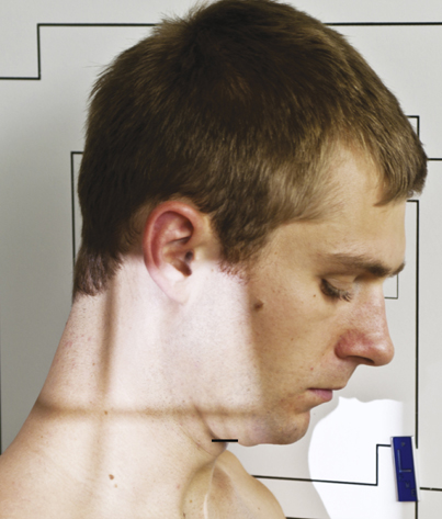 Bontrager's Textbook of Radiographic Positioning and Related Anatomy