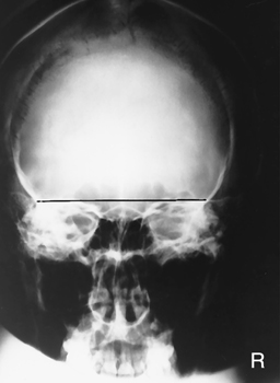 Bontrager's Textbook of Radiographic Positioning and Related Anatomy