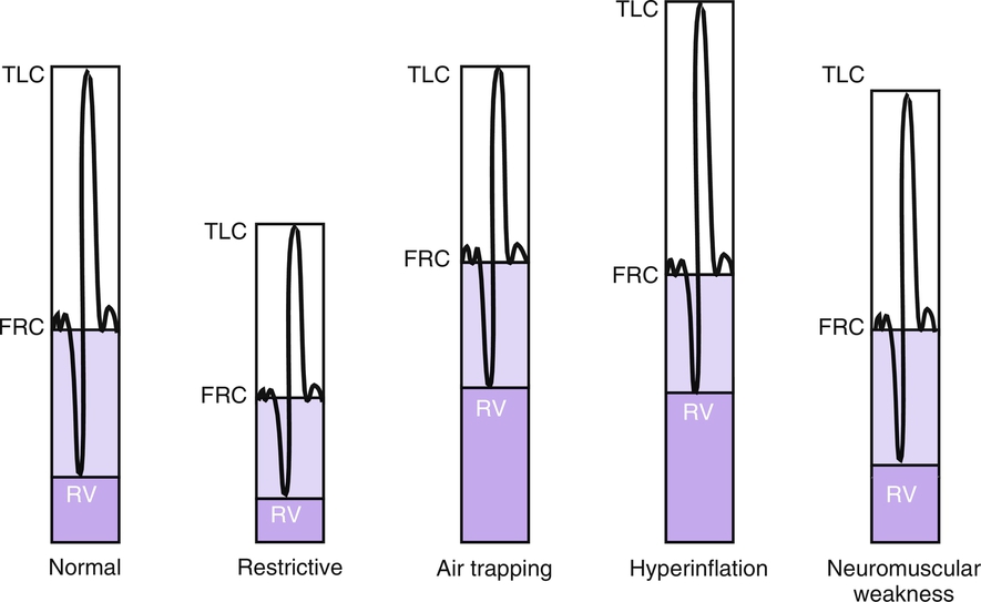 Fig. 4.8