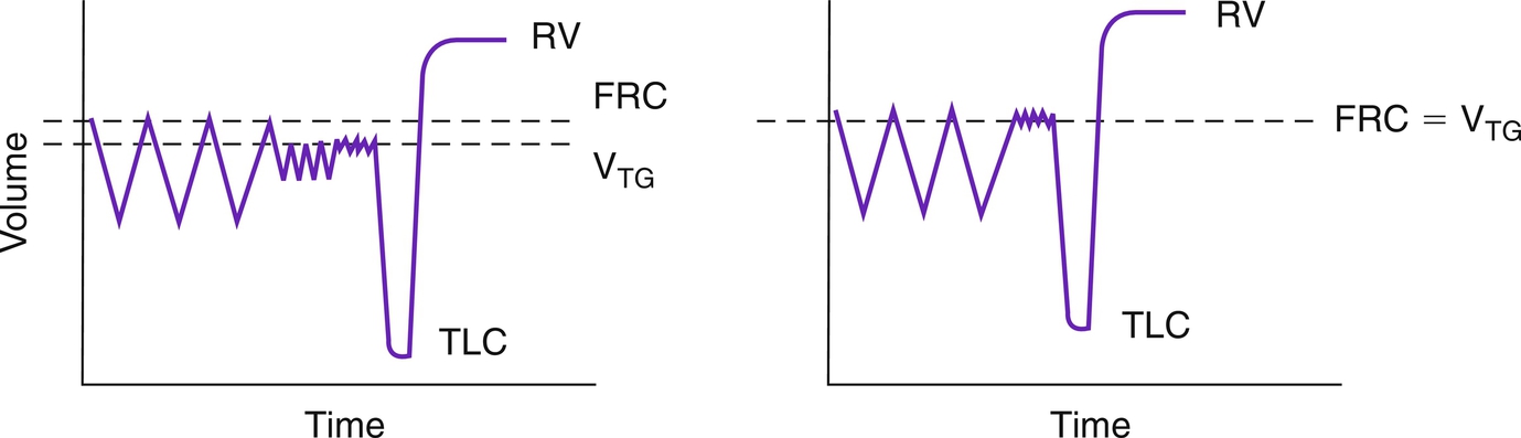 Ruppel's Manual of Pulmonary Function Testing