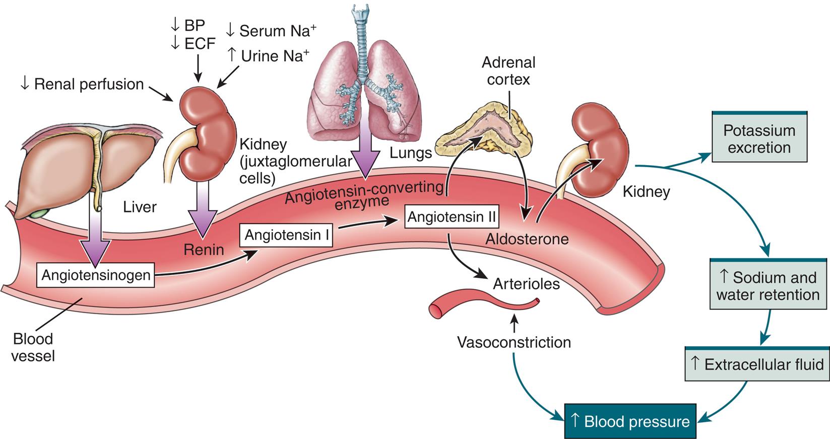 An illustrated flow diagram represents the renin-angiotensin-aldosterone system. The illustration shows a blood vessel. Liver secretes angiotensinogen in the blood vessel. Decreased renal perfusion, decreased blood pressure, decreased extracellular fluid, decreased serum sodium ions, and increased urine sodium ions in the juxtaglomerular cells of the kidney secretes renin in the blood vessel, converts angiotensinogen to angiotensin 1. Angiotensin-converting enzyme from the lung contribute to angiotensin 2. Angiotensin 2 affects adrenal cortex and arterioles. Adrenal cortex secretes to aldosterone, which affects the kidney. Kidney excretes potassium and leads to increased sodium and water retention, which results in increased extracellular fluid, contributing to increased blood pressure. Angiotensin 2 acts on arterioles, causing vasoconstriction, and results in increased blood pressure.