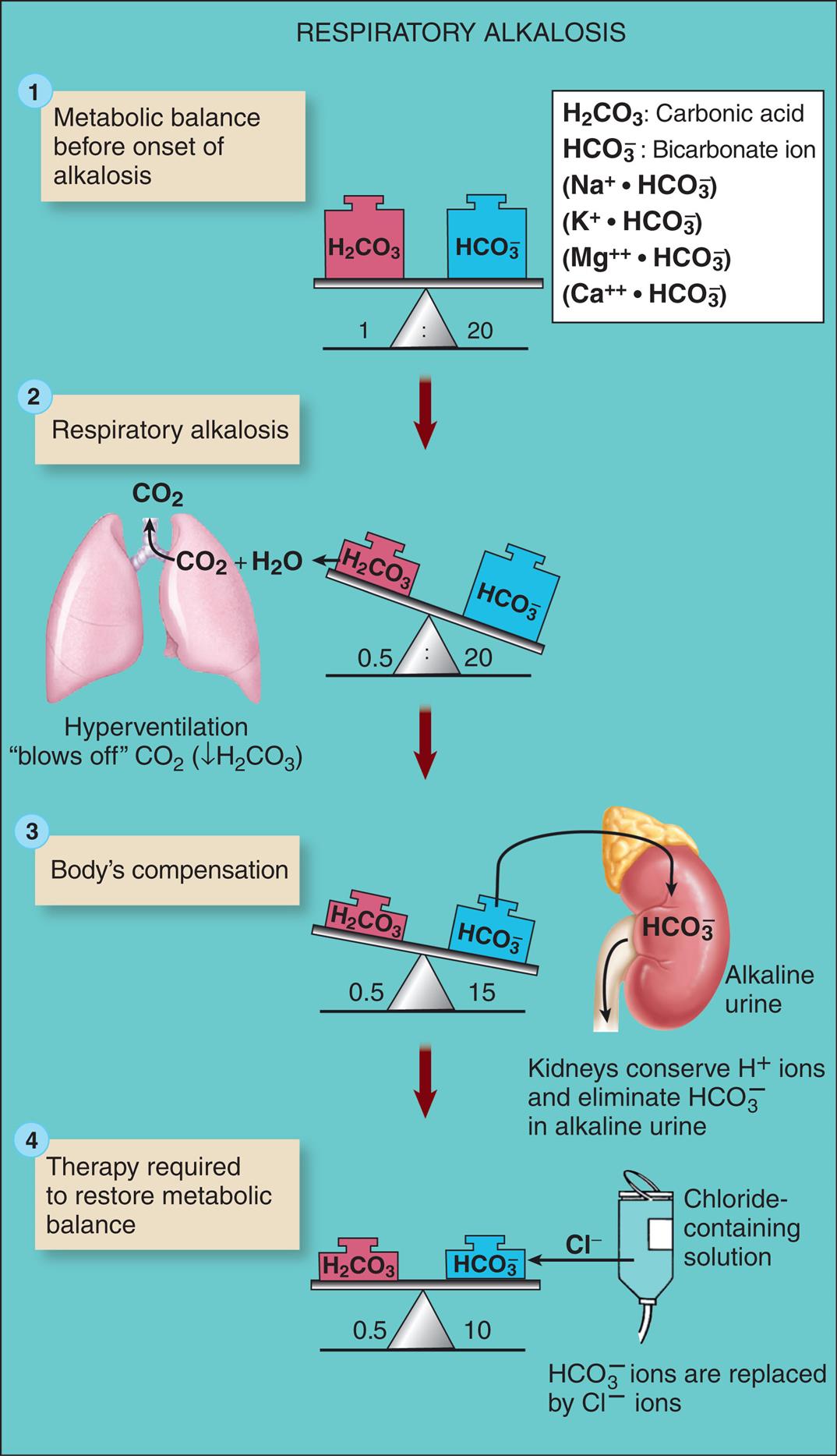 An illustrated flowchart shows the respiratory alkalosis process with compensation and correction. There are four stages in the process. 1. Metabolic balance before onset of alkalosis. Carbonic acid and bicarbonate ion are balanced in the ratio 1 to 20. 2. Respiratory alkalosis. Carbonic acid and bicarbonate ion are unbalanced in the ratio 0.5 to 20. Hyperventilation blows off C O 2 (decreased H 2 C O 3). 3. Body’s compensation. Carbonic acid and bicarbonate ion are unbalanced in the ratio 0.5 to 15. Kidneys conserve H ions and eliminate H C O 3 in alkaline urine. 4. Therapy required to restore metabolic balance. Carbonic acid and bicarbonate ion are balanced in the ratio 0.5 to 10. Chloride-containing solution used to replace H C O 3 ions with C l ions.