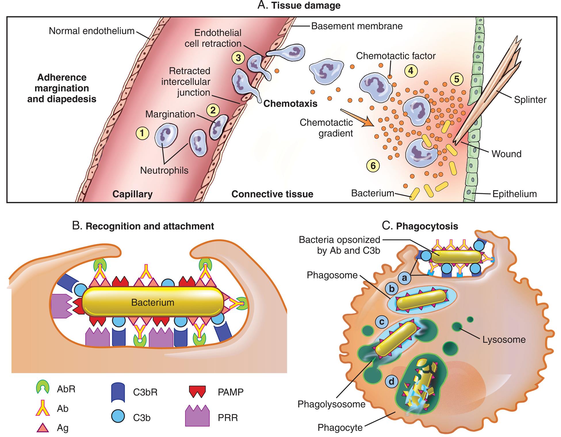 Three panels, A, B, and C, illustrate tissue damage, recognition and attachment, and phagocytosis, respectively. Top panel, tissue damage. An illustration shows a splinter punctured through the epithelium, causing a wound. A capillary with normal endothelium and a basement membrane contains white blood cells. Adherence margination and diapedesis of the blood cells is illustrated inside the capillary. 1. Neutrophils in the capillary. 2. Margination: cell moves closer to the endothelium. 3. Retracted intercellular junction: an open space between two endothelium cells. 4. Endothelial cell retraction: cell passe through the junction, chemotaxis. Bacterium from the site of the wound enters the connective tissue, which is combated by the white blood cells as a result of chemotactic gradient. Bottom left panel, recognition and attachment. An illustration shows a bacterium. Ligands and receptors binding to the ligands around the bacterium are as follows: • A g: A b R through A b. • C 3 b: C 3 b R. • P A M P: P R R. Bottom right panel, phagocytosis. An illustration shows bacterium being engulfed into the cell. The following structures in the cell are identified. • Bacteria opsonized by A b and C 3 b. • Phagosome. • Phagolysosome. • Phagocyte. • Lysosome.