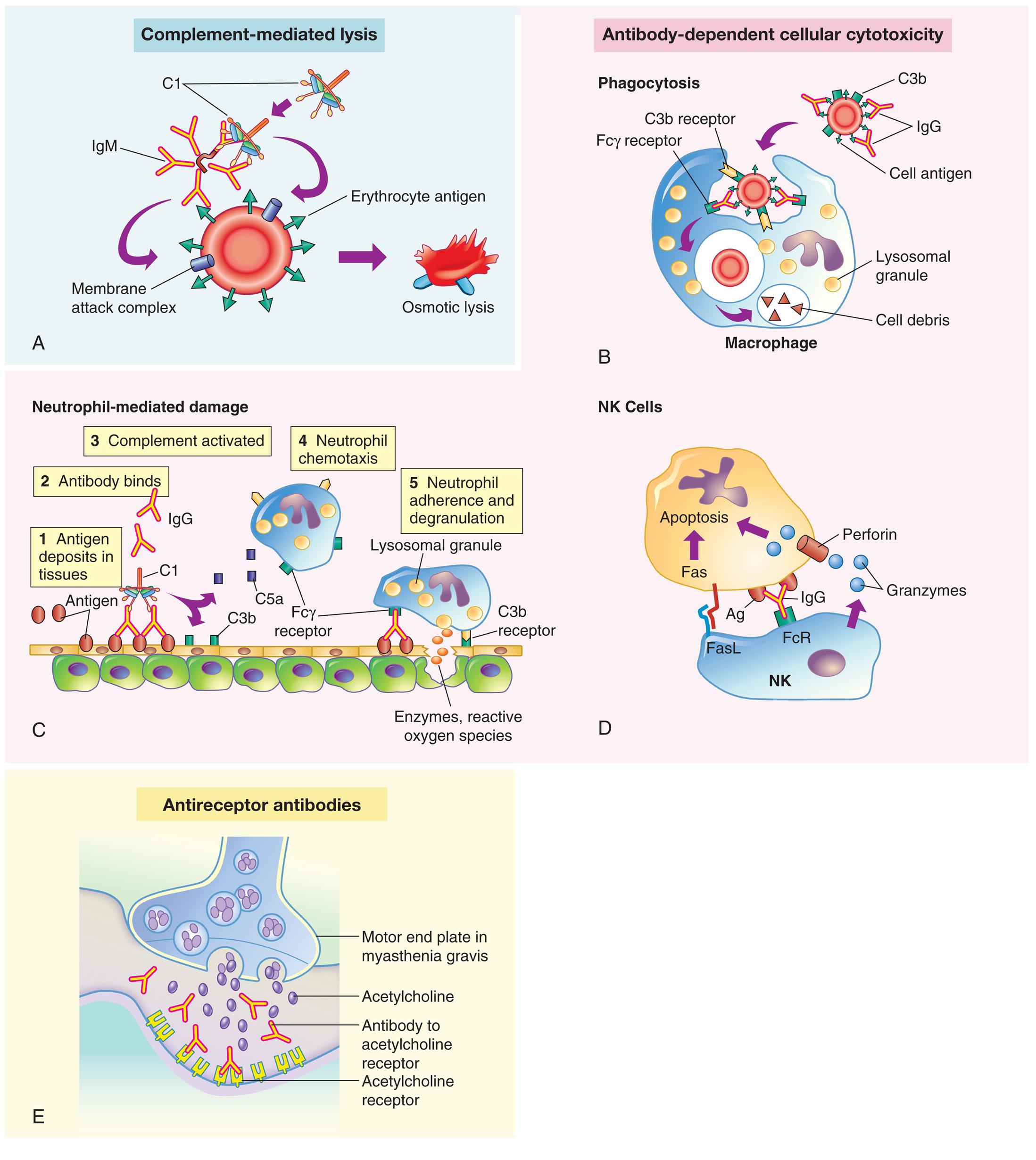 Five illustrations, A, B, C, D, and E, demonstrate the mechanisms of type 2, tissue-specific reactions. Illustration A, complement-mediated lysis. An I g M binds C 1, leading to a membrane attack complex on a blood cell, releasing erythrocyte antigen, and resulting in osmotic lysis. Illustration B, antibody-dependent cellular cytotoxicity: phagocytosis. C 3 b is attached to the blood cell. I g G binds to the cell antigen. C 3 b receptor binds C 3 b and F c gamma receptor binds the I g G, producing lysosomal granules and cell debris in the macrophage. Illustration C, antibody-dependent cellular cytotoxicity: neutrophil-mediated damage. The illustration shows an epithelial layer and shows the following sequence of damage: • Antigen deposits in tissues. • Antibody binds. • Complement activated: C 3 b and C 5 a. • Neutrophil chemotaxis: F c gamma receptor on the macrophage. • Neutrophil adherence and degranulation: release of lysosomal granules as enzymes, reactive oxygen species. Illustration D, antibody-dependent cellular cytotoxicity: N K cells. An N K cell comprises Fas L and F c R. Granzymes from the N K cell are attracted to the perforin of the apoptosis. I g G binds F c R in N K to A g in Apoptosis. Illustration E, antireceptor antibodies. The illustration shows the motor end plate in myasthenia gravis. Acetylcholine is released. Antibody to acetylcholine receptor binds to the acetylcholine receptor.