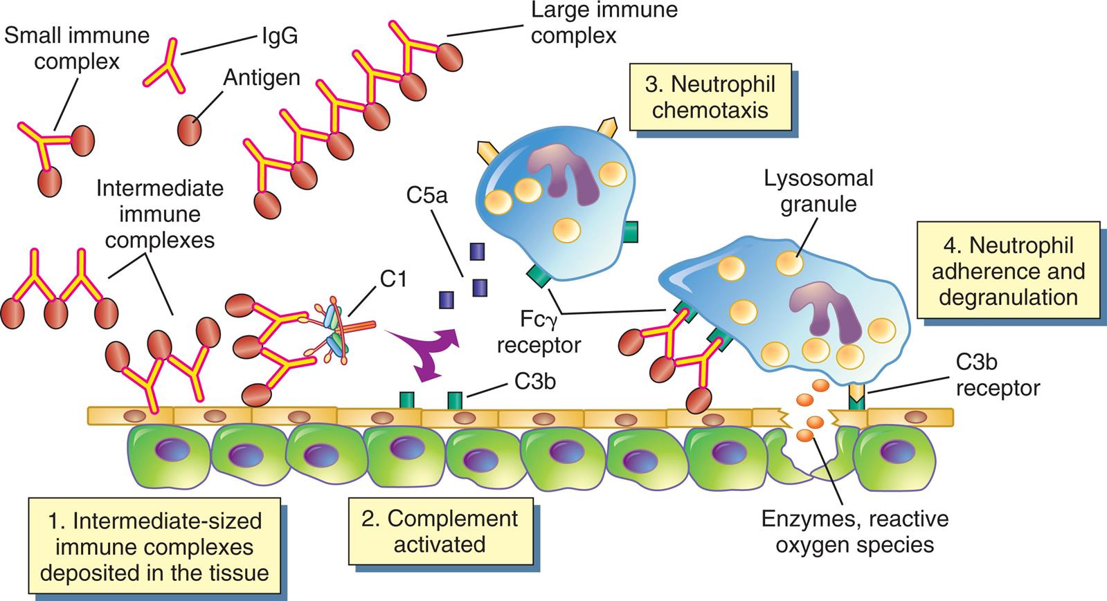 An illustration shows the mechanism of type 3, immune complex-mediated reactions. The illustration shows a I g G antibody and an antigen. A small immune complex is a structure with two antigens, one each on the paratopes of the I g G. Intermediate immune complexes are pairs of antibodies with antigens on the paratopes. A large immune complex is a chain of multiple antibodies with antigens on the paratopes. The mechanism of reactions are as follows. 1. Intermediate-sized immune complexes deposited in the tissue. 2. Complement (C 1, C 5 a) activated. 3. Neutrophil chemotaxis (F c gamma receptor). 4. Neutrophil adherence and degranulation (lysosomal granules, C 3 b receptor): enzymes, reactive oxygen species.