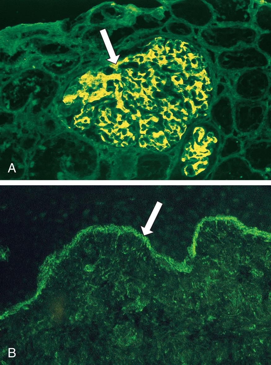Photomicrograph, A, shows an arrow pointing at neon green stained glomerulus. Photomicrograph, B, an arrow pointing to the dermal-epidermal junction.