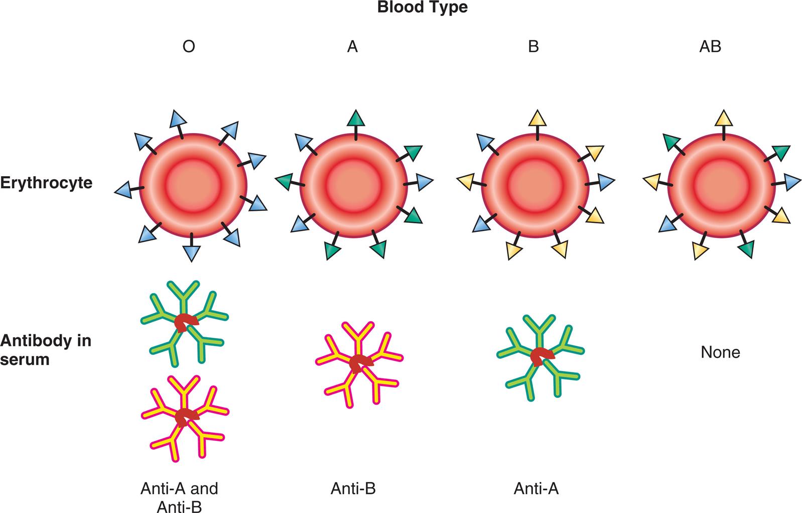 A series of illustrations shows A B O blood types. The erythrocyte for O blood type comprises H antigen, and the antibody in serum comprises anti-A and anti-B. The erythrocyte for A blood type comprises A antigen and H antigen, and the antibody in serum comprises anti-B. The erythrocyte for B blood type comprises B antigen and H antigen, and the antibody in serum comprises anti-A. The erythrocyte for A B blood type comprises A antigen, B antigen, and H antigen, and the there are no antibody in serum.