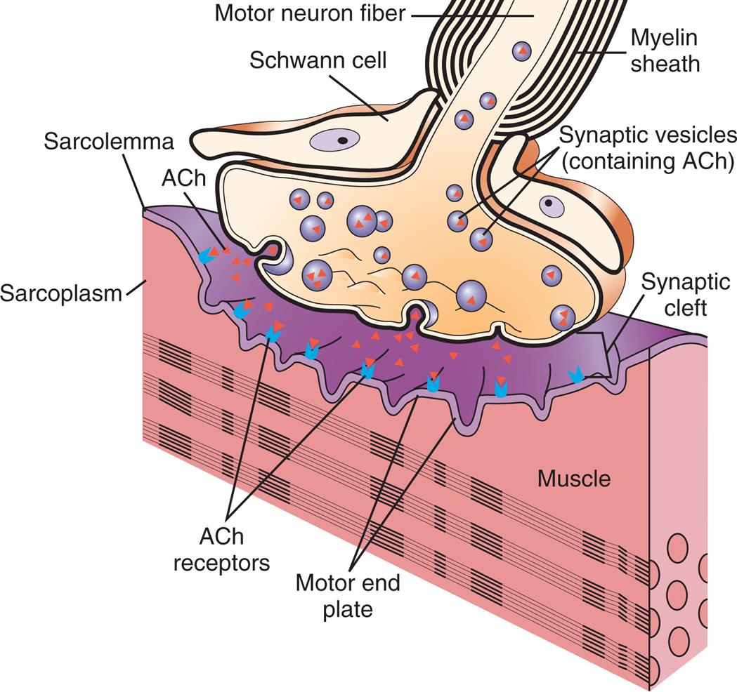 An illustration shows a cross-section of a normal neuromuscular junction. The following structures are labeled on the illustration: motor neuron fiber, myelin sheath, Schwann cell, synaptic vesicles (containing A C h), A C h, synaptic cleft, sarcolemma, A c h receptors, motor end plate, sarcoplasm, and muscle. Synaptic vesicles pass through the motor neuron fiber. The synaptic vesicles release A C h into the synaptic cleft which bind to the A C h receptors on the motor end plate.