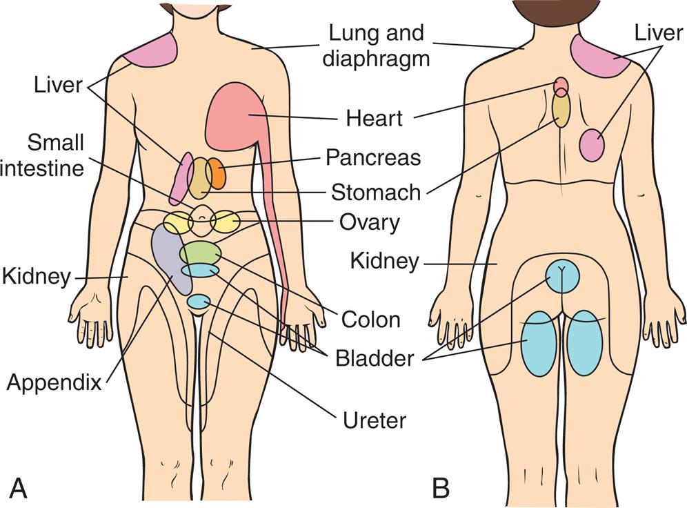 Two illustrations, A and B, depict the common areas of referred pain and their associated sites of origin labeled. Illustration A shows the anterior view of the human with the common areas of referred pain labeled as follows. Liver, small intestine, kidney, appendix, lung and diaphragm, heart, pancreas, stomach, ovary, colon, bladder, and ureter. Illustration B shows the posterior view of the human with common areas of referred pain labeled as follows. Lung and diaphragm, heart, stomach, kidney, bladder, and liver.