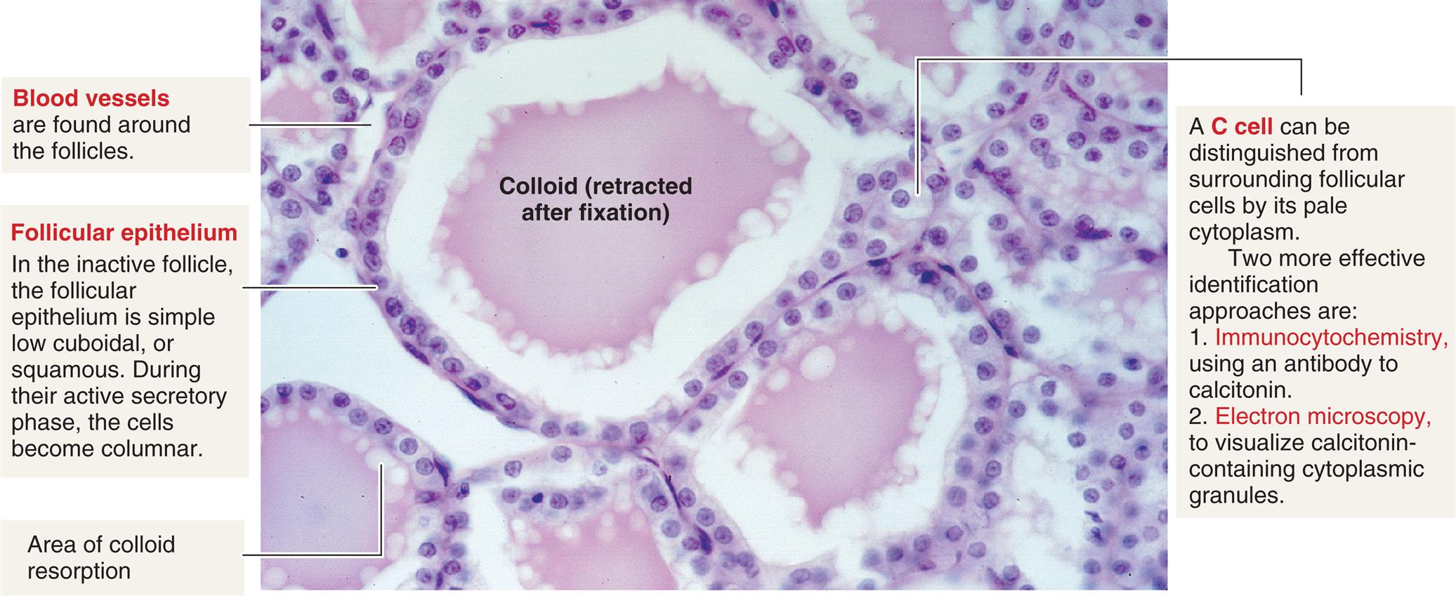A photomicrograph of thyroid follicle cells. The colloid (retracted after fixation) is labeled. Other structures labeled and described are as follows. • Blood vessels are found around the follicles. • Follicular epithelium. In the inactive follicle, the follicular epithelium is simple low cuboidal, or squamous. During their active secretory phase, the cells become columnar. • Area of colloid resorption. • A C cell can be distinguished from surrounding follicular cells by its pale cytoplasm. Two more effective identification approaches are: 1. Immunocytochemistry, using an antibody to calcitonin. 2. Electron microscopy, to visualize calcitonin-containing cytoplasmic granules.