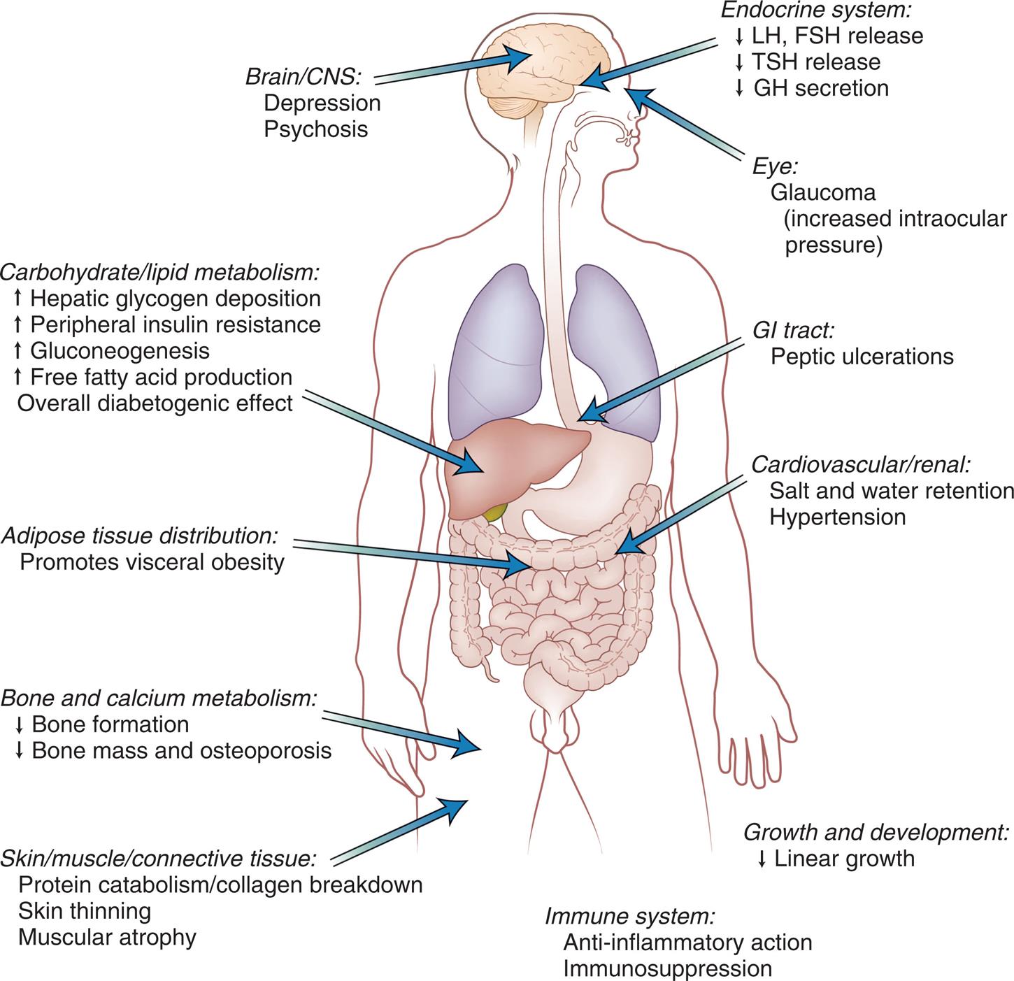 An illustration of the anterior view of a human figure shows and labels its different parts with corresponding effects. • Brain and C N S: depression and psychosis. • Endocrine system: decreased L H and F S H release, decreased T S H release, and decreased G H secretion. • Eye: Glaucoma (increased intraocular pressure). • G I tract: peptic ulcerations. • Carbohydrate or lipid metabolism: increased hepatic glycogen deposition, increased peripheral insulin resistance, increased glucogenesis, increased free fatty acid production, and overall diabetogenic effect. • Cardiovascular or renal: salt and water retention and hypertension. • Adipose tissue distribution: promotes visceral obesity. • Bone and calcium metabolism: decreased bone formation and decreased bone mass and osteoporosis. • Skin or muscle or connective tissue: protein catabolism or collagen breakdown, skin thinning, and muscular atrophy. • Growth and development: decreased linear growth. • Immune system: anti-inflammatory action and immunosuppression.