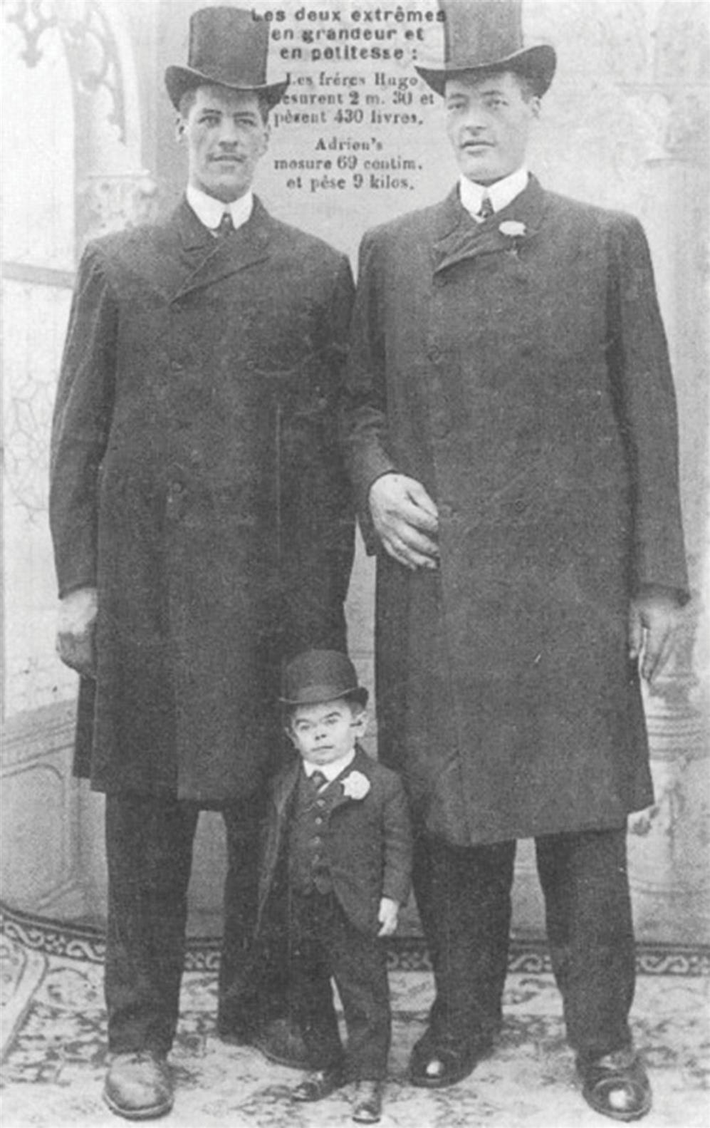 A black-and-white historical photo shows the brothers, Hugo and Adrien, both 230 centimeters tall, standing together. While the brothers have pituitary giantism. Adrien, 69 centimeters, standing between them, has hypopituitary dwarfism and stands just as tall as the brothers’ knees.