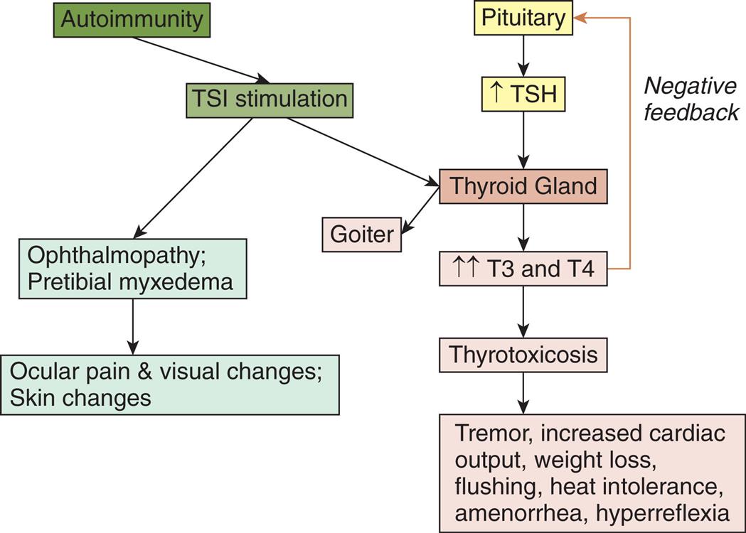 A flowchart shows the pathophysiology of Graves disease. There are three pathways. The first pathway is as follows. • Autoimmunity. • T S I stimulation. • Ophthalmopathy; pretibial myxedema. • Ocular pain and visual changes; skin changes. The second pathway is as follows. • Autoimmunity. • T S I stimulation. • Thyroid gland. • Goiter. The third pathway is as follows. • Pituitary. • Increased T S H. • Thyroid gland. • Increased T 3 and T 4. (negative feedback to pituitary) • Thyrotoxicosis. • Tremor, increased cardiac output, weight loss, flushing, heat intolerance, amenorrhea, and hyperreflexia.